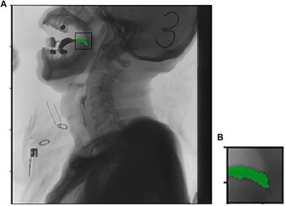 Dynamic Target Tracking Method Based on Medical Imaging